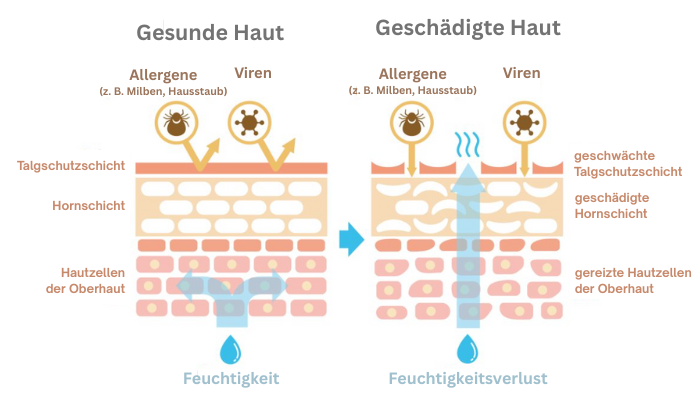 Hautschichten erklärt
